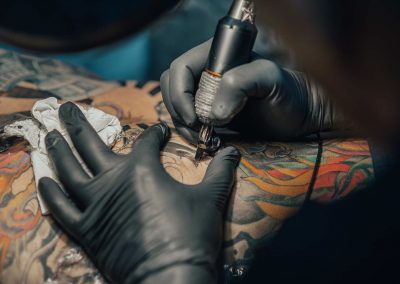032925_TattooInkAllergy_04a