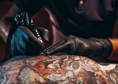 032925_TattooInkAllergy_04b