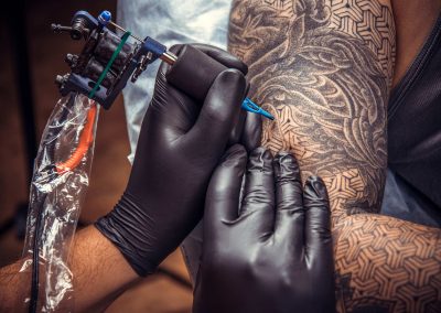 032925_TattooInkAllergy_04c