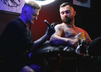032925_TattooInkAllergy_04d