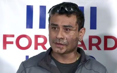 Heinous acid attack against Milwaukee man being investigated as racially motivated hate crime
