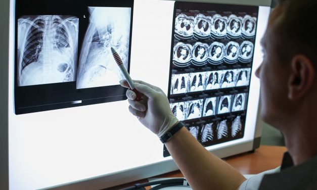 The impact from COVID-19 on healthy lungs can range from no symptoms to severe pneumonia